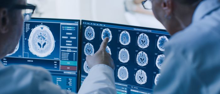 Two doctors looking at brain scans