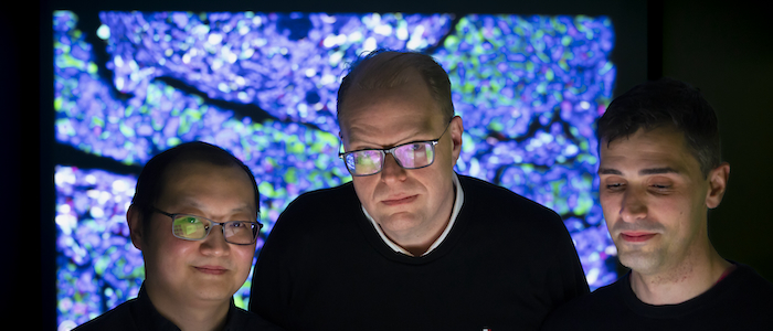Dr Ke Yuan, Professor John Le Quesne and Dr Adalberto Claudio Quiros stand in front of a projection of one of the cancer sample slides used to train the machine learning algorithm used in the study.