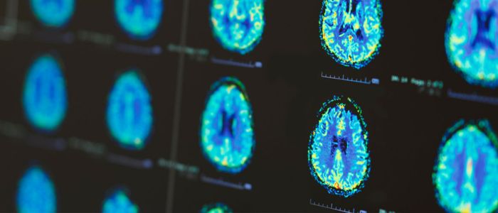 Brain scans on a computer