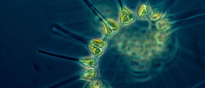 Close up microscopy image of phytoplankton