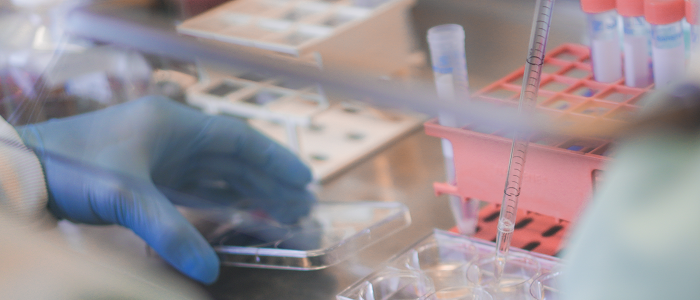 Lab work on tissue sample, gloved hands