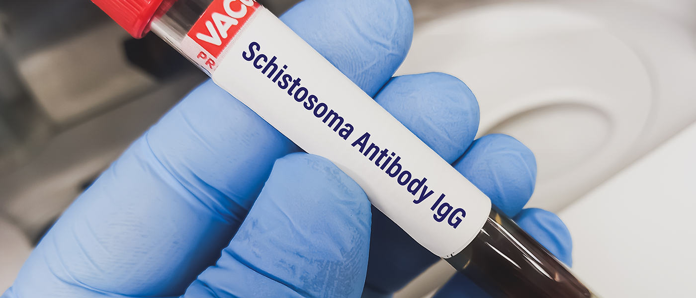 gloved hand holding testtube