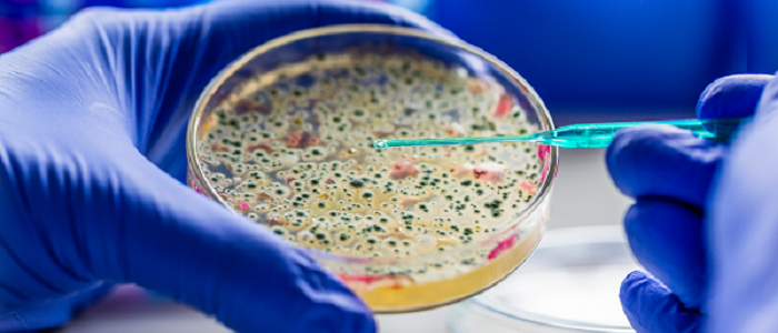 Gloved hands holding petri dish of bacteria culture