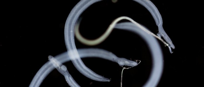 The schistosomiasis parasite under the microscope