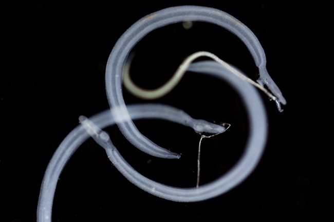 The schistosomiasis parasite under the microscope