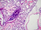 Pathogen