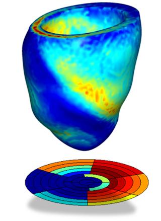 impaired heart function