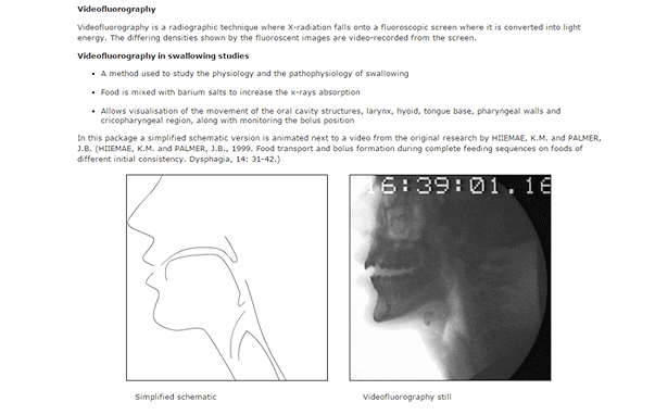 Swallowing package is included in Anatomy and Physiology 