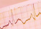 Advancing diagnosis of heart disorders