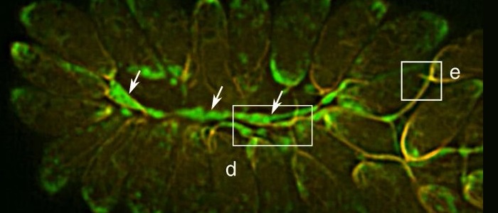 Toxoplasmosis 700x300