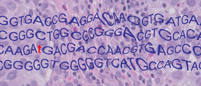Histopathological image of tumour with a mutated DNA sequence
