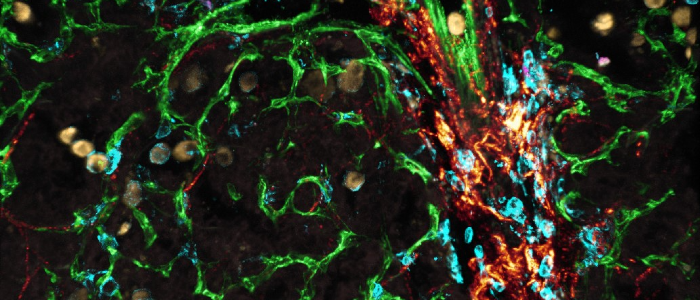 Ximena using live lung slices in KM mice