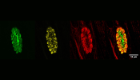 The image shows intracellular parasites that are connected by the intravacuolar network. The disassembly of this network is one of the first crucial steps for the parasite to exit from the host cell.