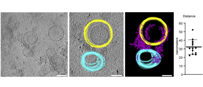 Segemented slices through cryo-electron tomogram showing exocyst-mediated liposome tethering