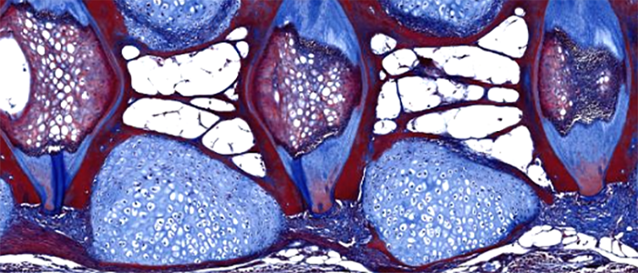 Fish spine massons trichrome