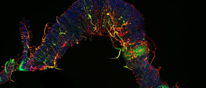 Fly gut and remaining Vasculature